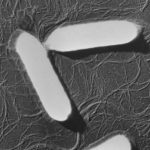 ボツリヌス菌電子顕微鏡写真
